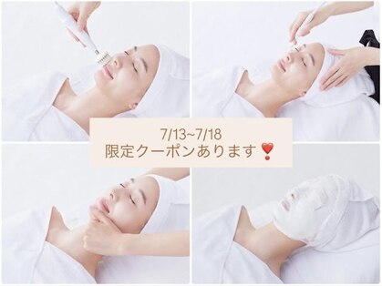 アイオンの写真