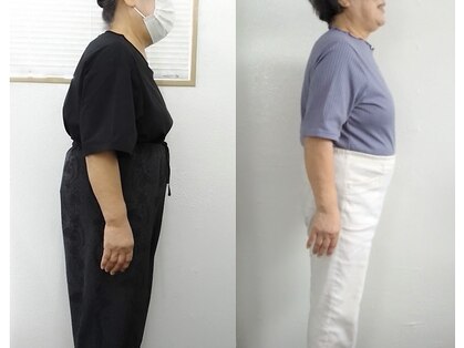 コレットの写真