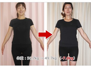 かんだ接骨院/ダイエット30代のエイジングケア