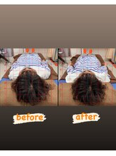 ブライト整体(Bright整体)/姿勢矯正【首肩こり/猫背】