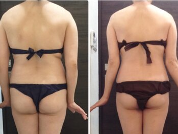 美容整体 ウェリナ 蟹江院/小顔矯正/骨盤矯正/美脚サロン