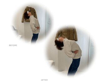 整体ライト 国分寺店(LIGHT)/Before→After（腰）