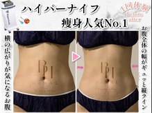 ビナル(BeNAL)の雰囲気（誰にも知られず◇プライベート隠れサロン◇）