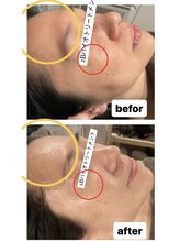 シャムリー 並木坂(Syamry)/シワに結果を出す悩み改善ハーブ