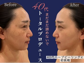 ナンバー19(N°19)