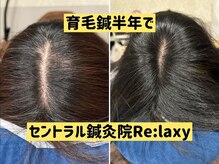 セントラル鍼灸院リラクシー(Re:laxy)
