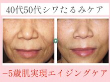 デュモンド(dumonde)