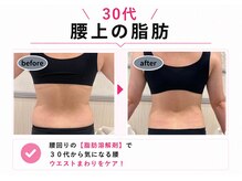 クリニカルエステ/イーズ パークプレイス大分店の雰囲気(1回の施術です!凝り固まった背中~腰回りを1回でスッキリ!)