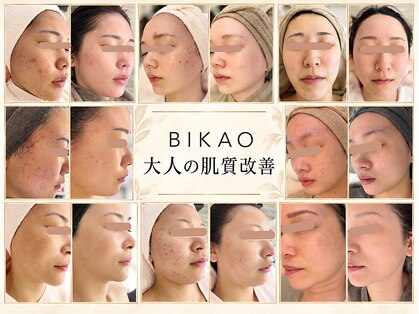 ビカオ(BIKAO)の写真