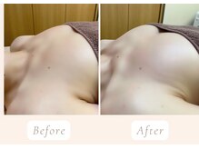 ノルン(Norn)/40代美乳バストアップ（12回目）