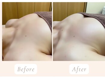 ノルン(Norn)/40代美乳バストアップ（12回目）