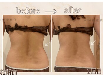 アンバー 恵比寿(AMBER)/ウエストラインを綺麗に出したい
