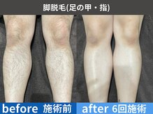 アテ 古波蔵店(ATE)の雰囲気（施術だけでなく丁寧な徹底カウンセリングで素敵な自愛時間を◎）