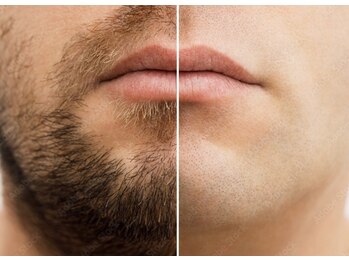 ナルフロウ(nalufurou)