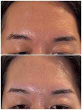 スリーピース(3Peace)/BEFORE／AFTER