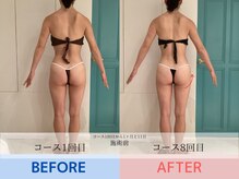 エル 麻布十番(LllL)/【痩身】1ヶ月ビフォアフ