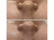 ワイグレイス(Y.GRACE)/エクラボーテフェイシャル