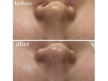 ワイグレイス(Y.GRACE)/エクラボーテフェイシャル