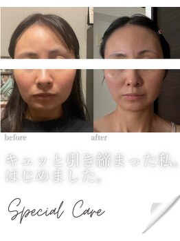 リノン(LIINON)/引き締まった私。始めました!