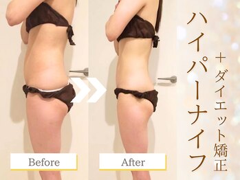 グレースフル/Before&After