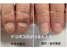 ネイルズシアム