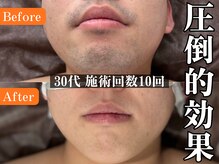 ボス 名古屋店(BOSS)