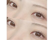 オメメビューティー(Omeme Beauty)