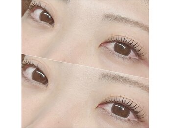 オメメビューティー(Omeme Beauty)