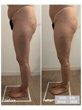 エムプラス(Mplus.)/話題のビジリス♪