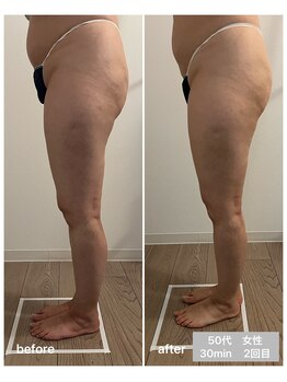 エムプラス(Mplus.)/話題のビジリス♪