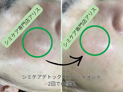 アリス 心斎橋店(alice)の写真