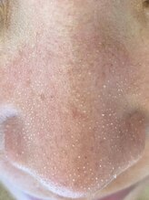 ロンハナ(lonhana)