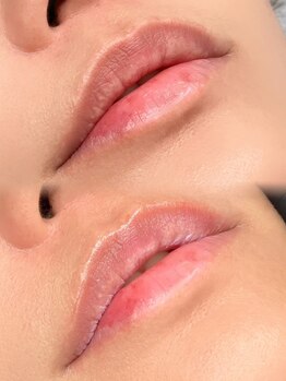 ヤエシーファイブクリニック(YAE C5 CLINIC)/札幌/ローマピンク