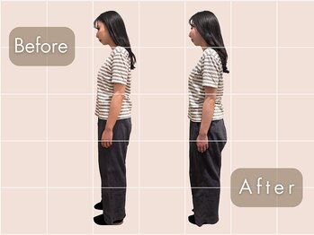 整体サロン イチ(ICHI)/姿勢改善before/after[目黒]