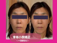 ダイダイ(daidai)/