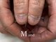 エムアンド(M and)の写真/深爪プロにお任せ！一人で悩まず二人三脚で理想の指先へ☆噛み癖、むしり癖を改善し憧れの美爪へ