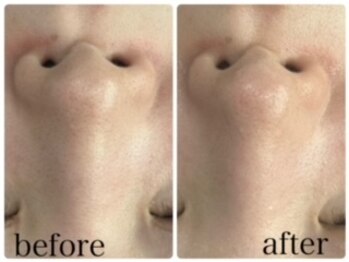 エクラニーク(Eclanique)/ムートンホイップスパ