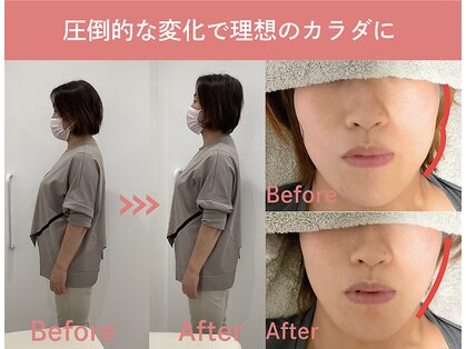 ブルーム(Bloom)の写真