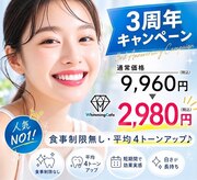 歯のホワイトニング 岐阜アクティブG店