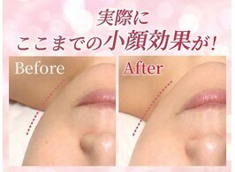 リフト 荻窪(Lift)｜ホットペッパービューティー