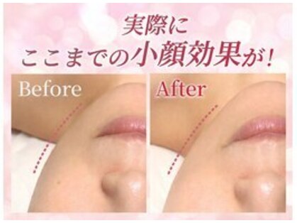リフト 荻窪(Lift)の写真