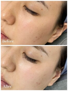 ピュア 川越店/サロンピュアスペシャルコース