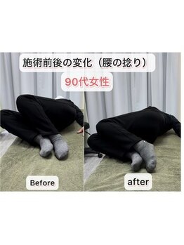 シオ 横浜関内(sio)/施術後の変化BeforeAfter