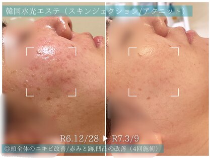 ラ ドゥーサ(La Dusa)の写真