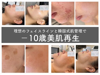 エスビューティー 三軒茶屋(S beauty)の写真