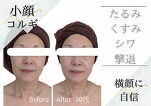 エミニー バイ エルズ(Eminy by L★s)