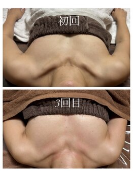 エース(A)/CカップからＥカップへ