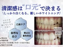 ホワイトニングショップ 福岡香椎店