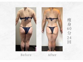 エヴァーグレース 三河安城店(EVER GRACE)/【ボディー管理】痩身60