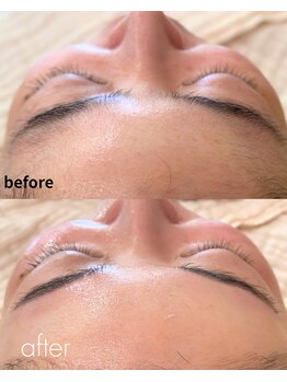 ビジ(biji)/効果がすぐに。